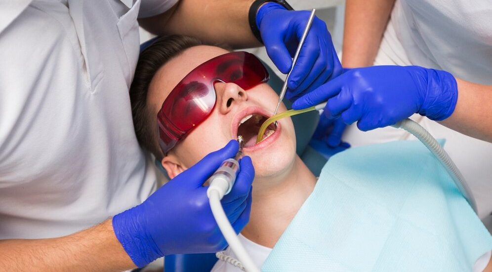 Root Canal Treatment
